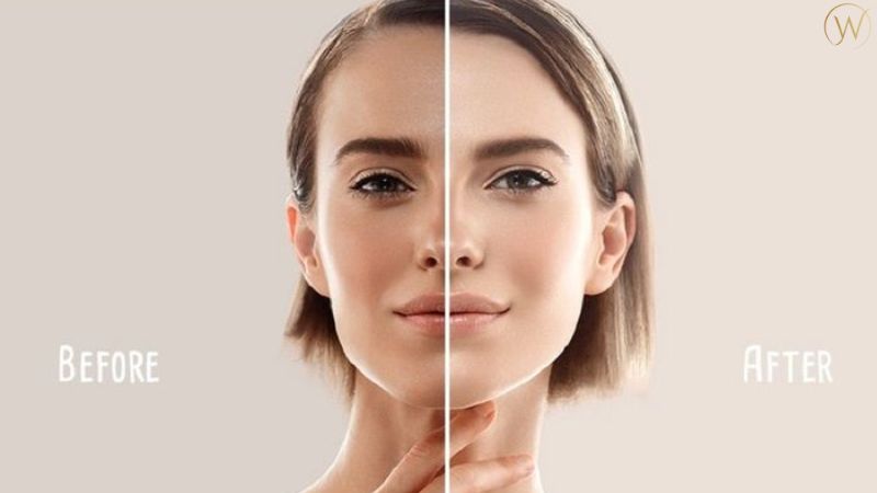 Alpha Arbutin 對肌膚有什麼功效?