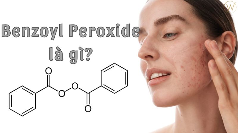 Benzoyl Peroxide là gì?