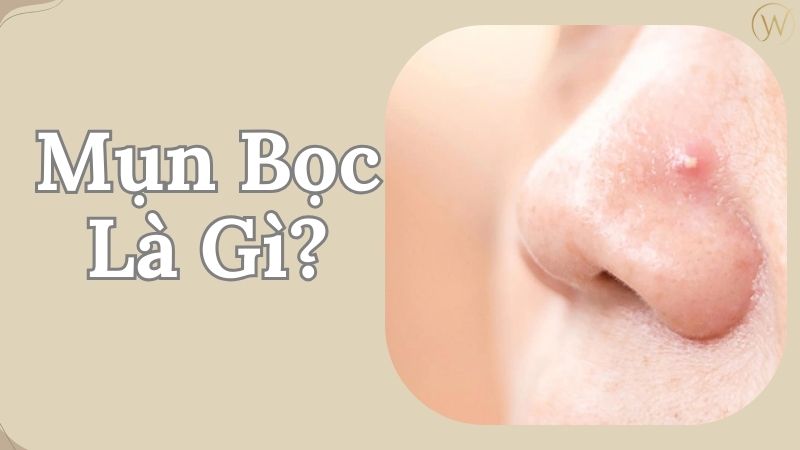 Mụn bọc là gì?